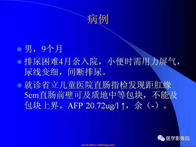 【病例】盆腔胚胎性横纹肌肉瘤1例CT影像表现