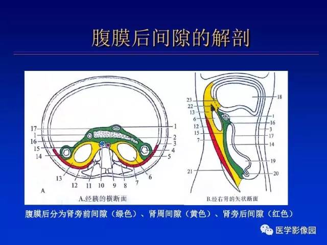 【PPT】原发腹膜后肿瘤影像表现及鉴别诊断思路