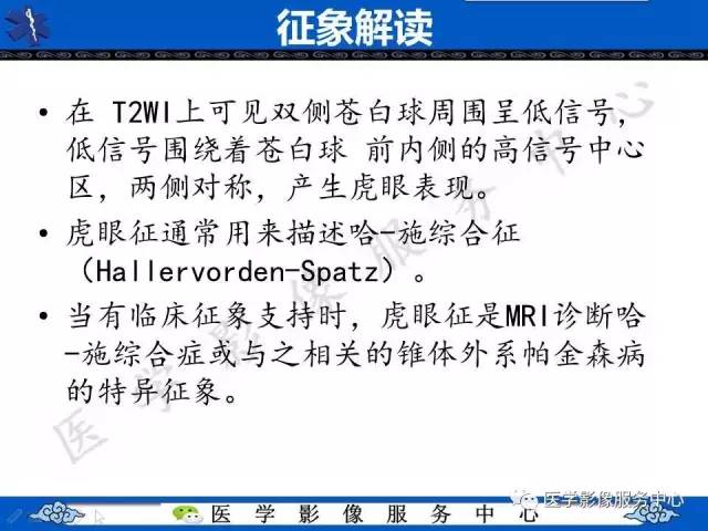 【影像征象】虎眼征
