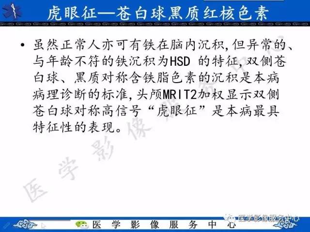 【影像征象】虎眼征
