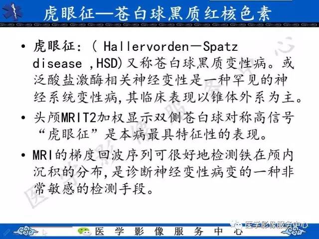 【影像征象】虎眼征