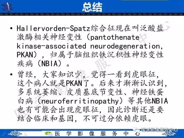 【影像征象】虎眼征