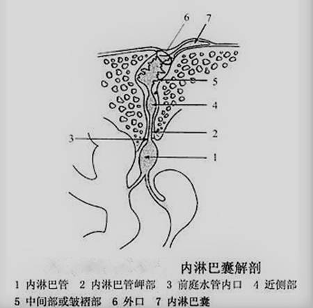 你听都没有听过的——内淋巴囊瘤 你听都没有听过的——内淋巴囊瘤