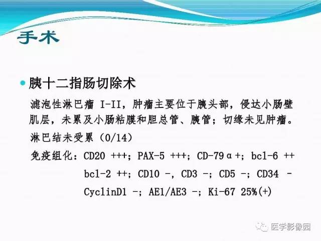 【病例】胰腺淋巴瘤1例CT影像表现