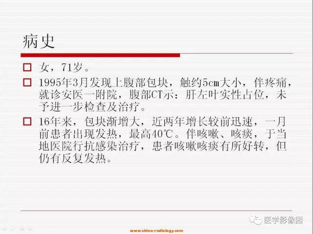【病例】胃肠道间质瘤1例CT影像表现