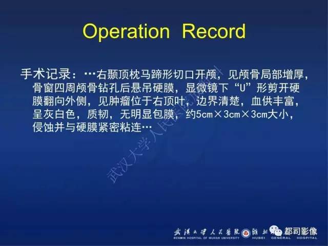 【病例】颅内孤立性纤维瘤1例MR影像诊断
