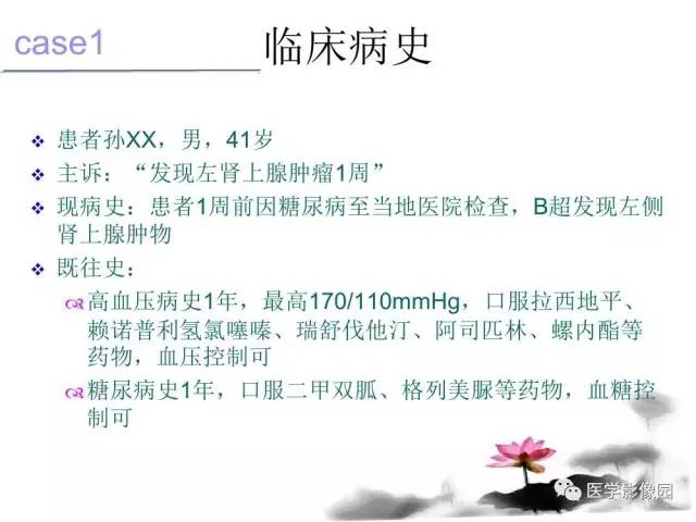 【病例】左肾上腺及腹膜后嗜铬细胞瘤1例MR