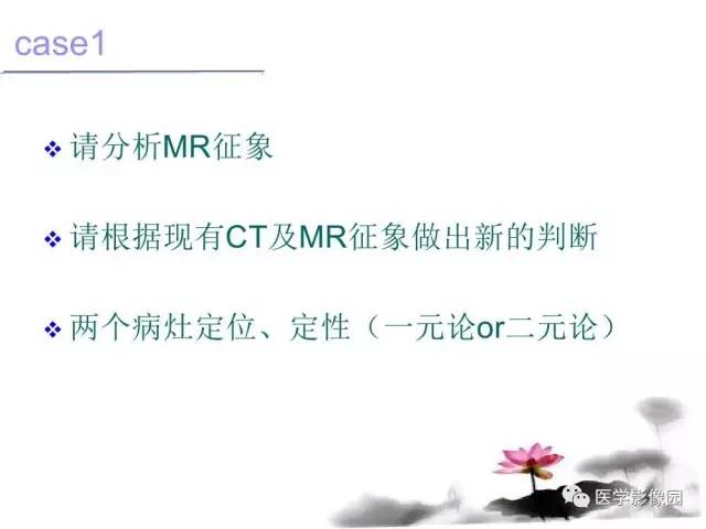 【病例】左肾上腺及腹膜后嗜铬细胞瘤1例MR