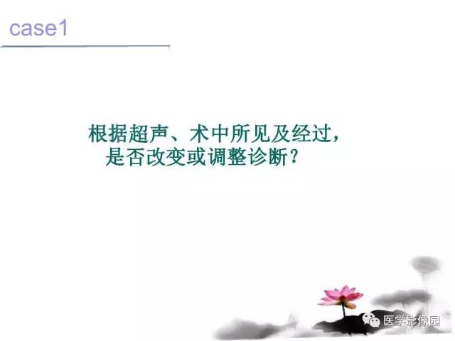 【病例】左肾上腺及腹膜后嗜铬细胞瘤1例MR