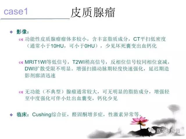 【病例】左肾上腺及腹膜后嗜铬细胞瘤1例MR