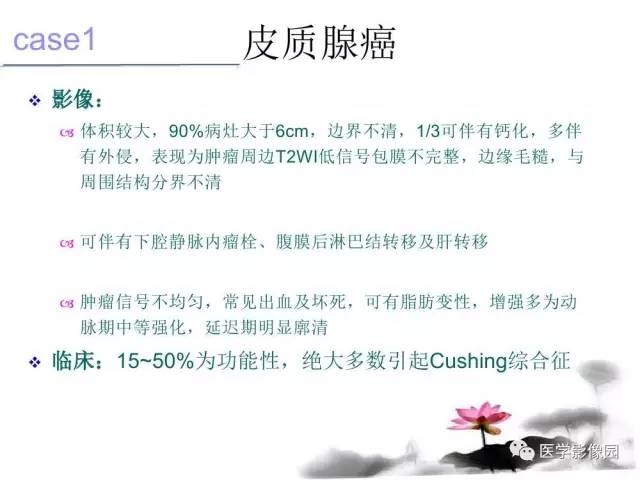【病例】左肾上腺及腹膜后嗜铬细胞瘤1例MR