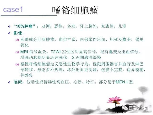 【病例】左肾上腺及腹膜后嗜铬细胞瘤1例MR