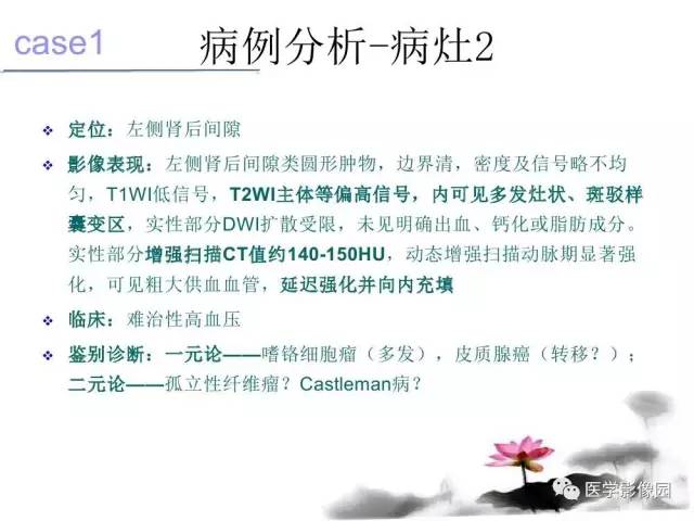 【病例】左肾上腺及腹膜后嗜铬细胞瘤1例MR