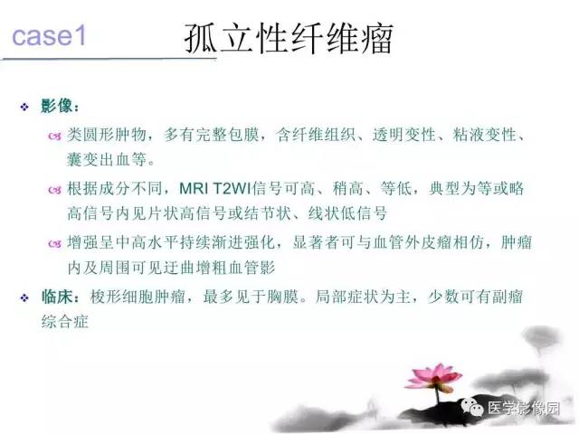【病例】左肾上腺及腹膜后嗜铬细胞瘤1例MR