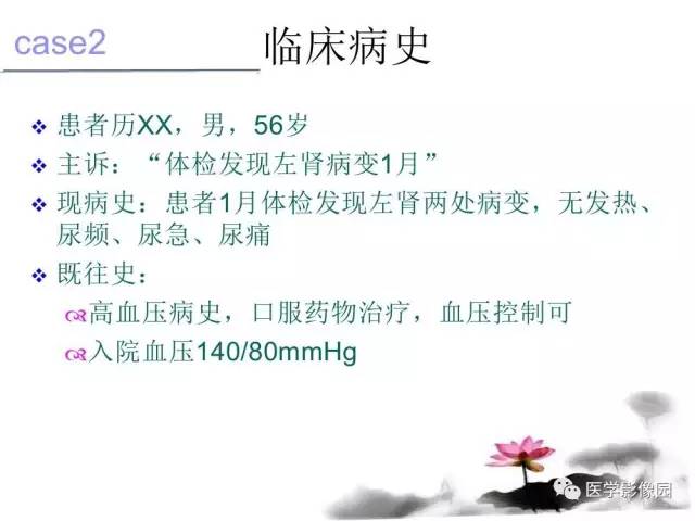 【病例】左肾嫌色细胞肾癌+透明细胞肾癌1例MR影像分析
