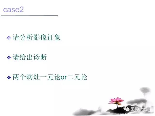 【病例】左肾嫌色细胞肾癌+透明细胞肾癌1例MR影像分析