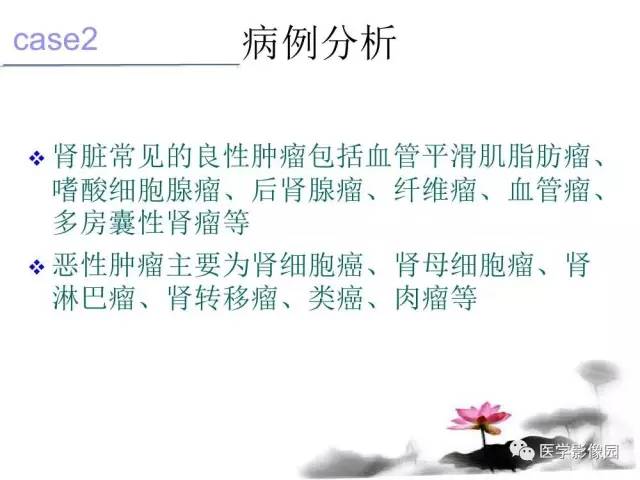 【病例】左肾嫌色细胞肾癌+透明细胞肾癌1例MR影像分析