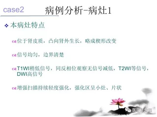 【病例】左肾嫌色细胞肾癌+透明细胞肾癌1例MR影像分析
