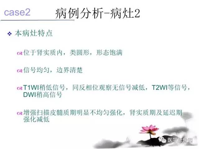【病例】左肾嫌色细胞肾癌+透明细胞肾癌1例MR影像分析