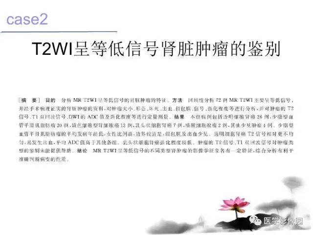 【病例】左肾嫌色细胞肾癌+透明细胞肾癌1例MR影像分析