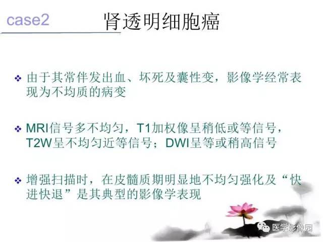 【病例】左肾嫌色细胞肾癌+透明细胞肾癌1例MR影像分析