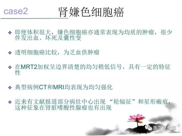 【病例】左肾嫌色细胞肾癌+透明细胞肾癌1例MR影像分析