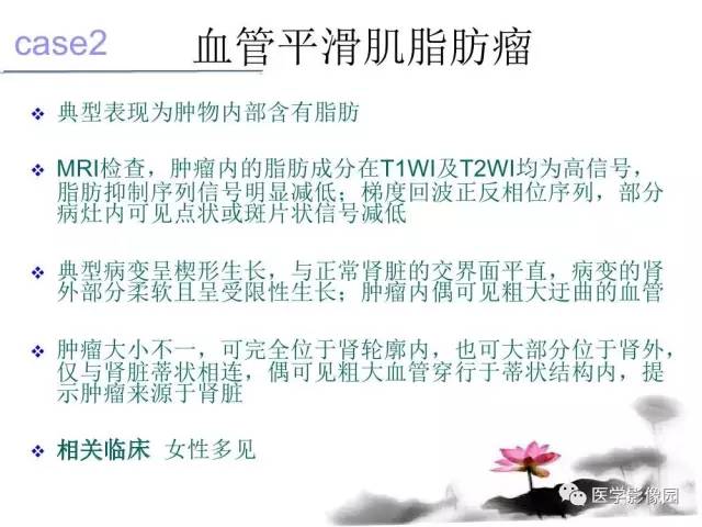 【病例】左肾嫌色细胞肾癌+透明细胞肾癌1例MR影像分析