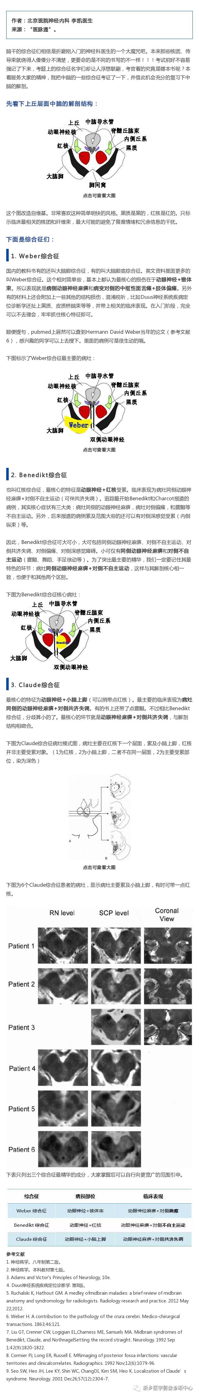 中脑解剖及几个血管综合征