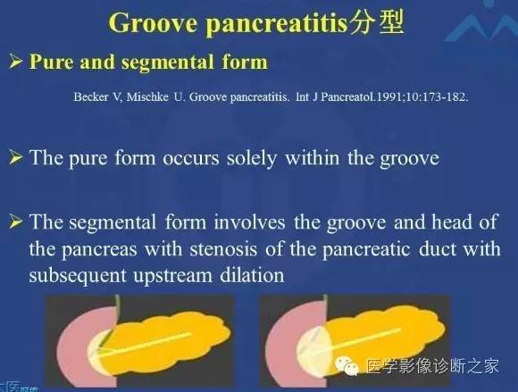 【PPT】沟区胰腺炎CT、MRI及临床相关性