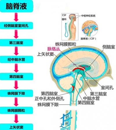 自发性低颅压综合症