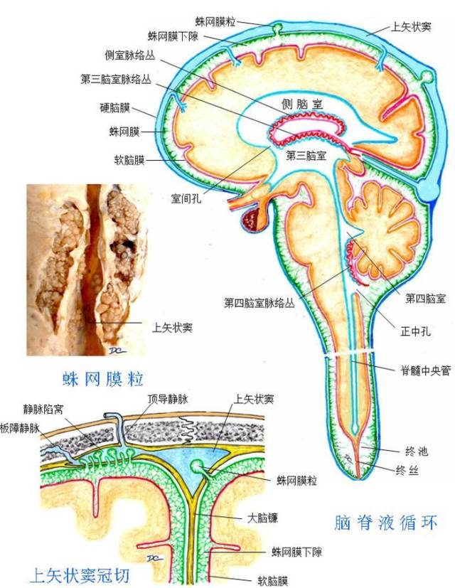 自发性低颅压综合症