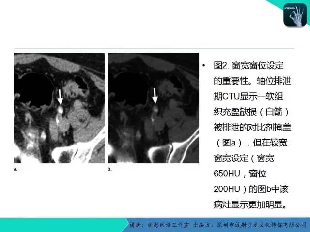 【PPT】​CT尿路造影对输尿管疾病的评价