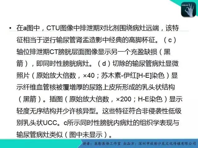 【PPT】​CT尿路造影对输尿管疾病的评价