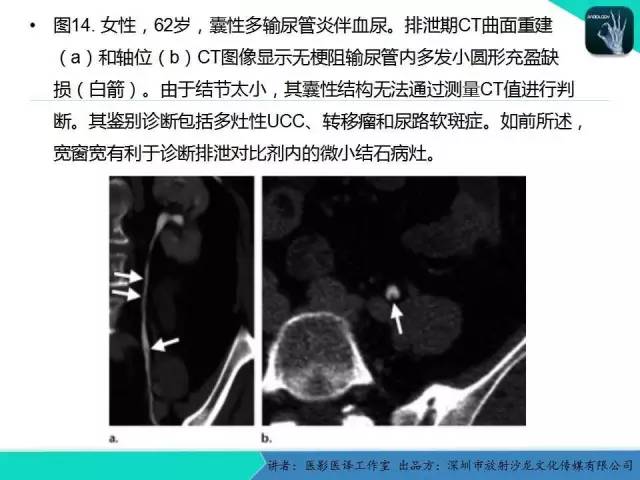 【PPT】​CT尿路造影对输尿管疾病的评价