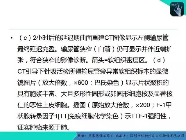 【PPT】​CT尿路造影对输尿管疾病的评价