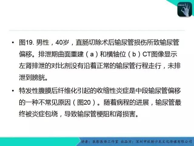 【PPT】​CT尿路造影对输尿管疾病的评价
