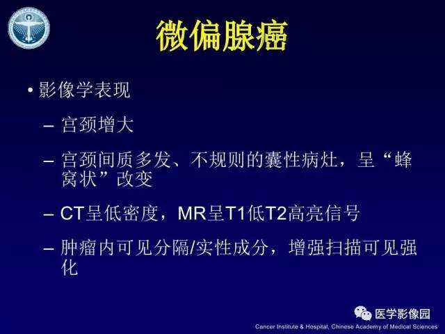 【病例】宫颈腺癌伴卵巢转移1例MR