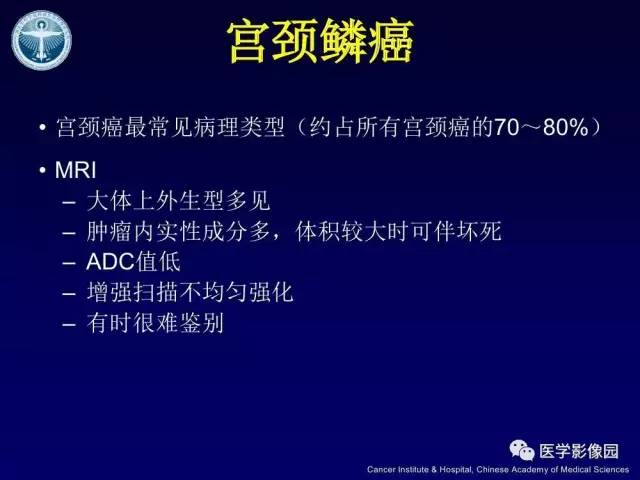 【病例】宫颈腺癌伴卵巢转移1例MR