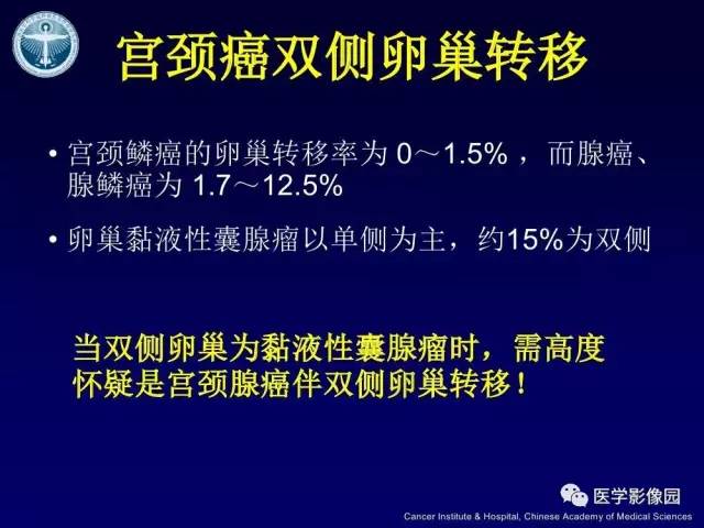 【病例】宫颈腺癌伴卵巢转移1例MR