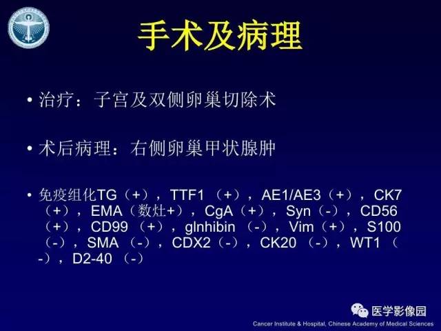 【病例】卵巢甲状腺肿1例CT及MR