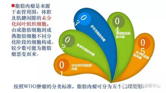 【病例】腹膜后脂肪肉瘤1例CT