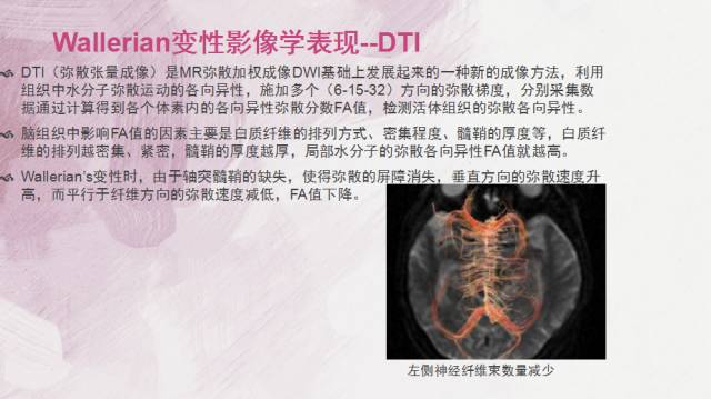 【PPT】Wallerian变性是什么？