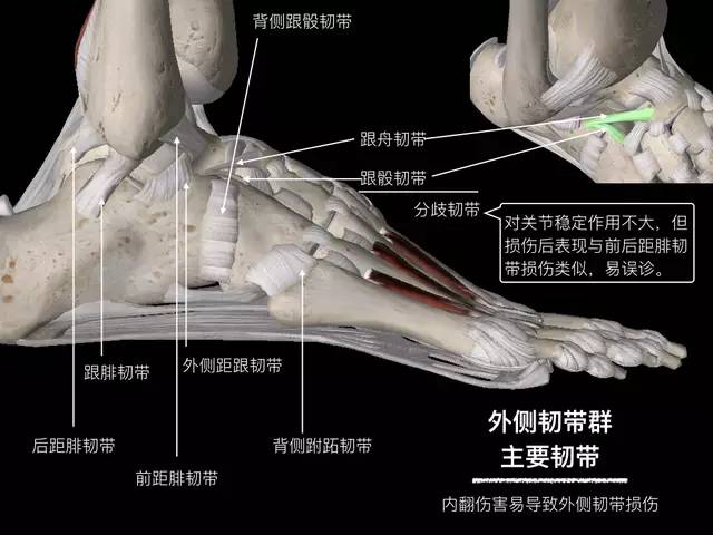 【病例】踝关节韧带解剖学