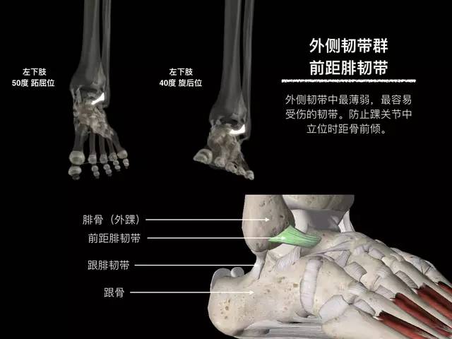 【病例】踝关节韧带解剖学