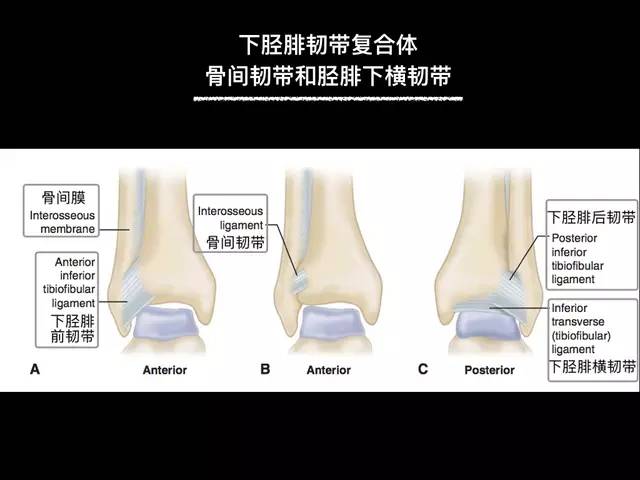 【病例】踝关节韧带解剖学