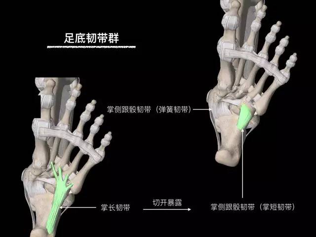 【病例】踝关节韧带解剖学