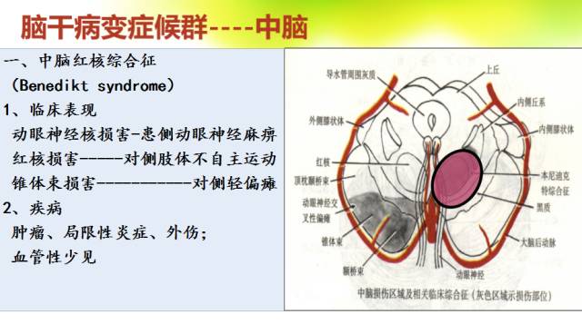【PPT】脑干影像解剖及诊断