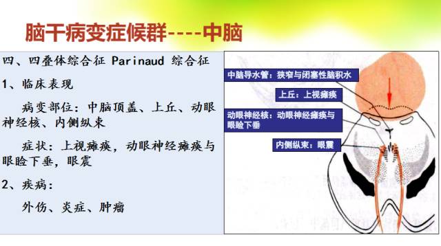 【PPT】脑干影像解剖及诊断
