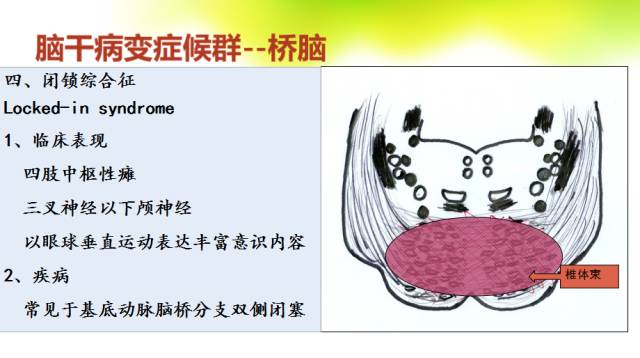 【PPT】脑干影像解剖及诊断
