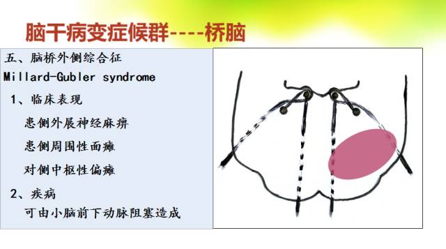 【PPT】脑干影像解剖及诊断